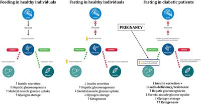 <mark class="highlighted">Ramadan</mark> Fasting and Maternal and Fetal Outcomes in Pregnant Women with Diabetes Mellitus: Literature Review